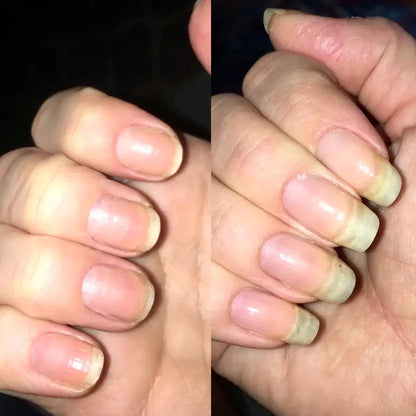Nail Strengthener With Keratin, Calcium & Nourishing Oils – BMNL Beauty
